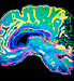 colorful brain image